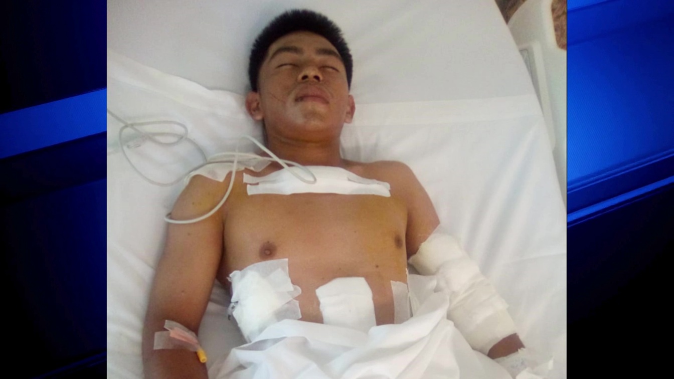 Father Finds Son Stabbed, Clinging to Life