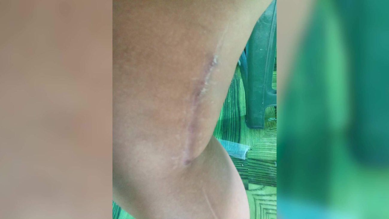 After Losing Arm in Attack, Navas Fights to Rebuild